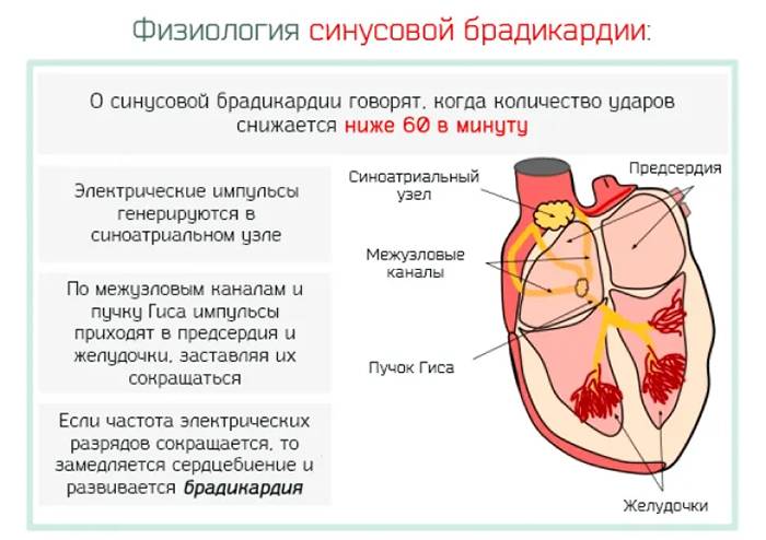 Брадикардия: причины, симптомы и лечение патологии - причины, диагностика и лечение