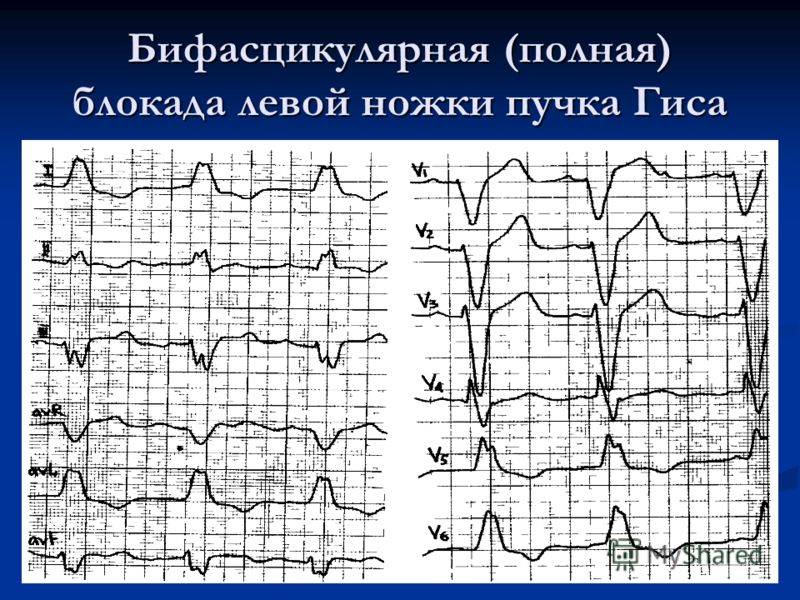 Пнпг что это значит у взрослого