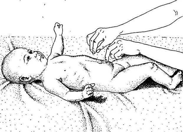 Техника и эффективность массажа при пупочной грыже у новорожденных - proinfospine