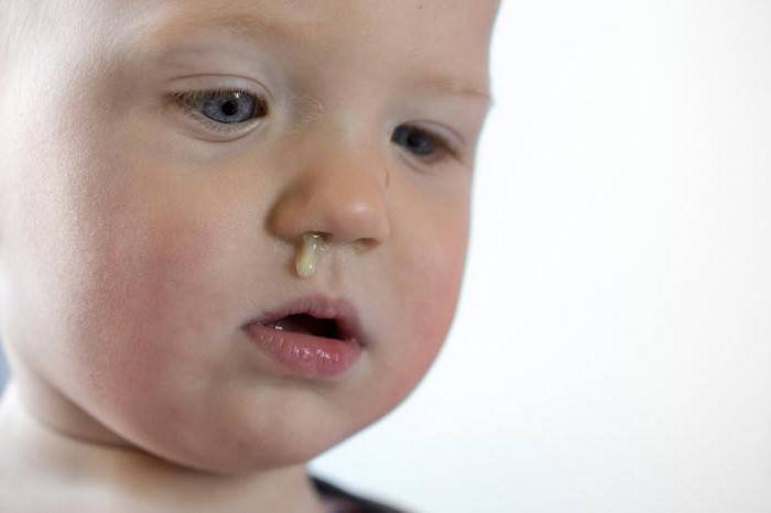 Детская простуда: симптомы, лечение ребенка, что делать при первых признаках болезни