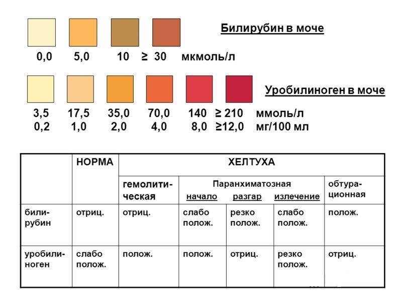 Общий анализ мочи у детей.