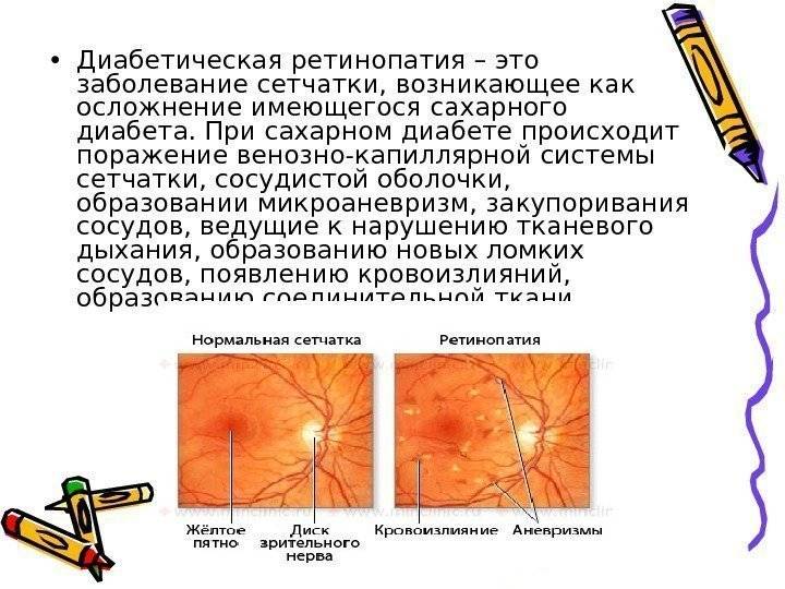 Сахарная слепота. Диабетическая ретинопатия сетчатки. Диабетическая ретинопатия изменения глазного дна. Изменение сетчатки при сахарном диабете. Глазное дно при сахарном диабете.