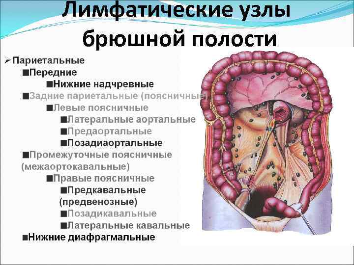 Что такое лимфаденопатия брюшной полости у детей