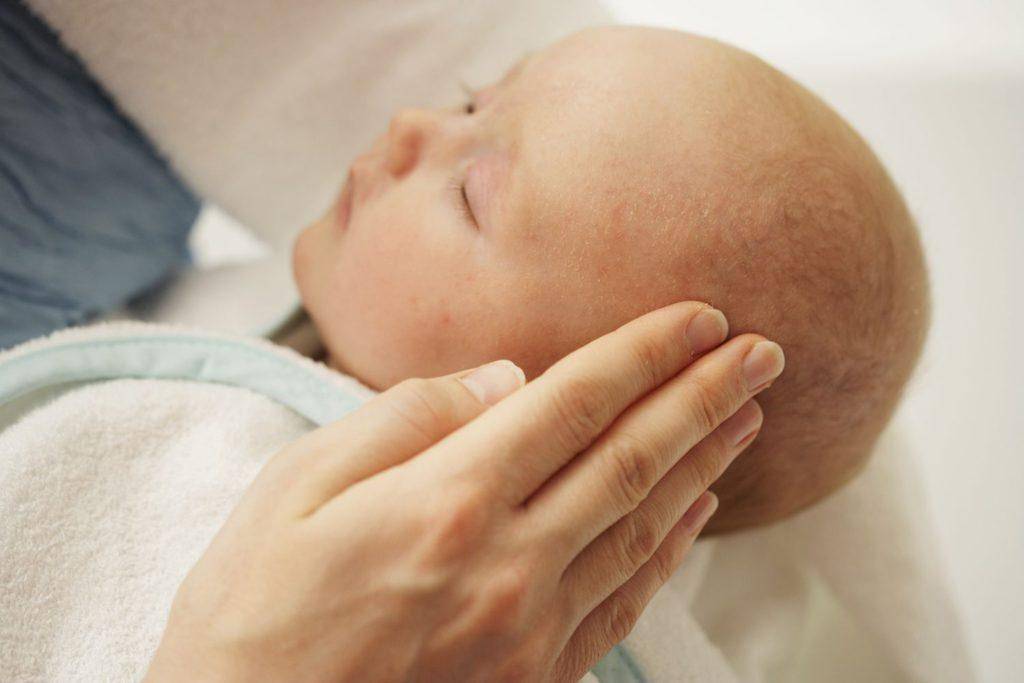Кожа новорожденных: эритема, шелушение, высыпания. что делать? уход за новорожденным