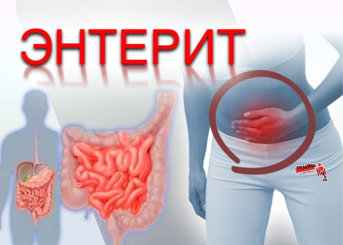 Аденовирусный энтерит