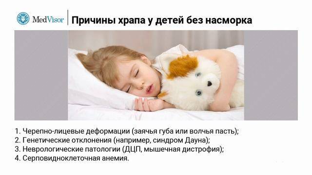 Ребенок храпит во сне