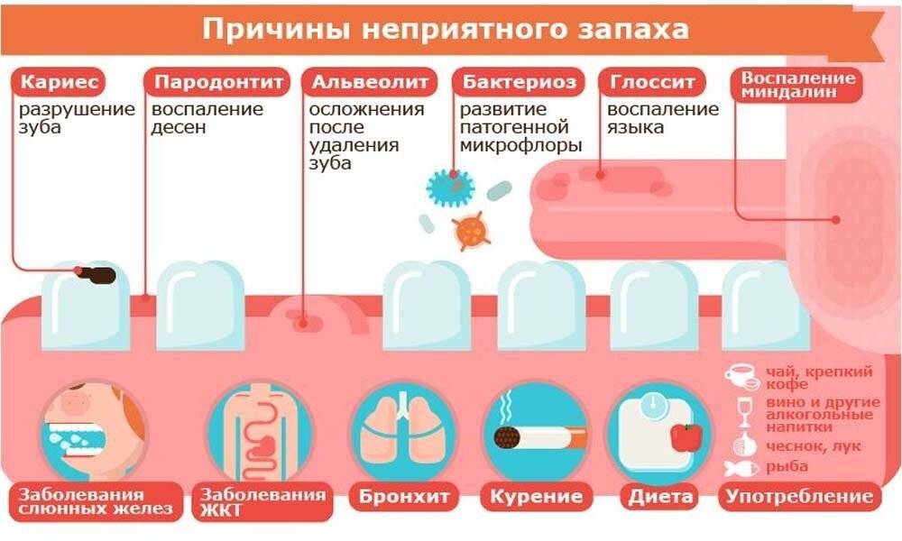 Неприятный запах изо рта у ребенка- причины и лечение