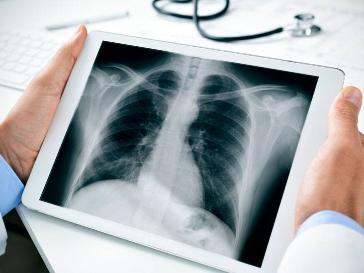 Что вреднее, кт или рентген? сравнение компьютерной томографии и рентгенографии.