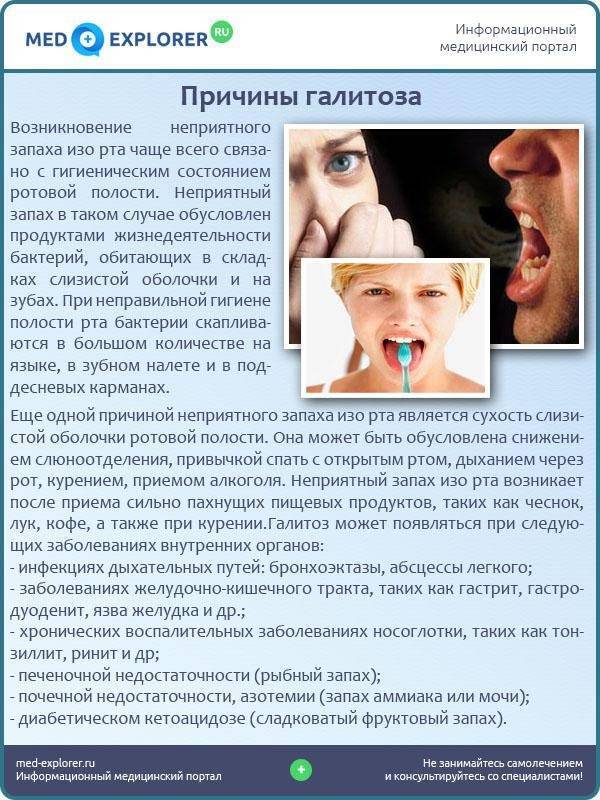 Причины запаха изо рта