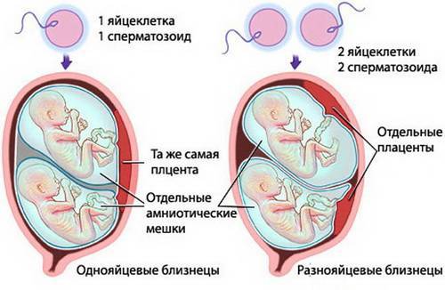 На каком сроке рождается двойня, во сколько недель двойняшки считаются доношенными?
