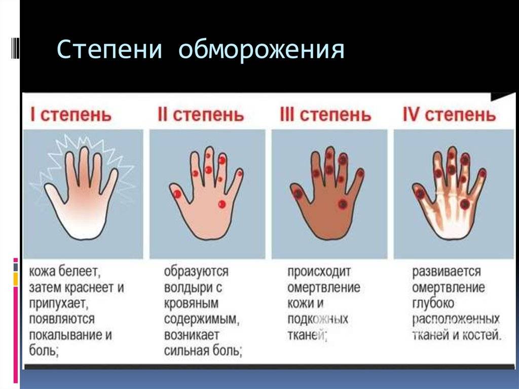 Первая помощь при обморожении рук, ног, пальцев, лица у ребёнка, симптомы, степени