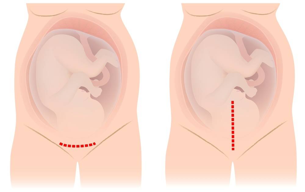 Лохии после родов: сколько длятся и как выглядят? советы гинеколога.