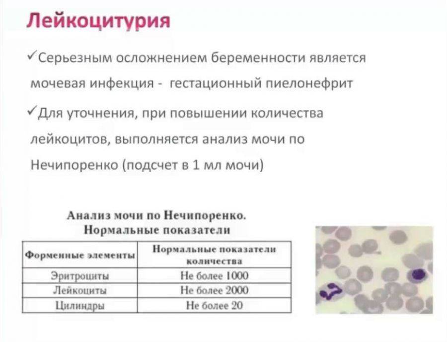 Повышенные лейкоциты в моче у грудничка ~ детская городская поликлиника №1 г. магнитогорска