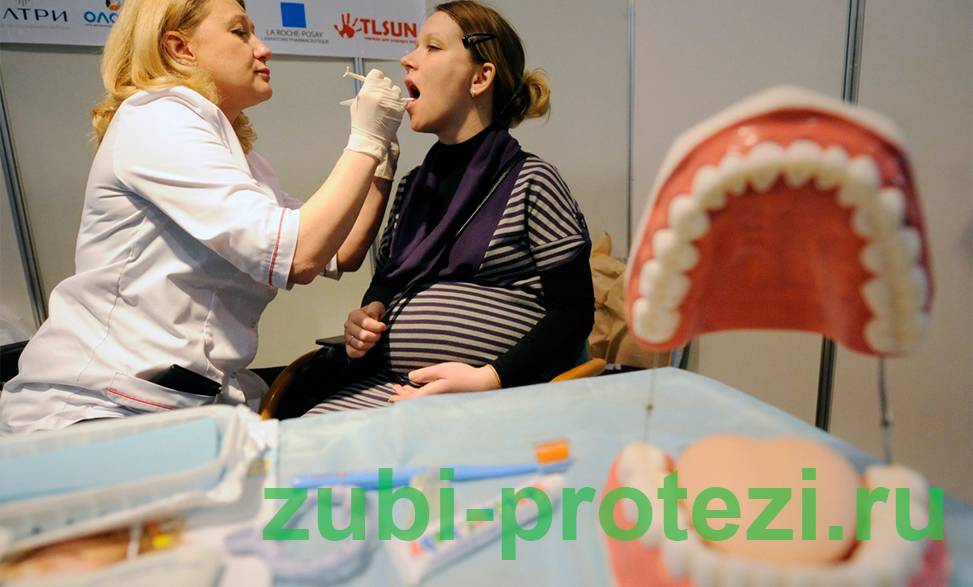 Какую анестезию лучше делать беременным женщинам при стоматологическом лечении