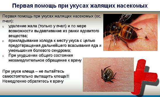 Аллергия на укус пчелы: симптомы, лечение