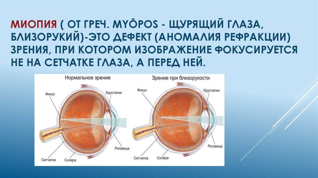 Психосоматика близорукости, дальнозоркости и других глазных болезней