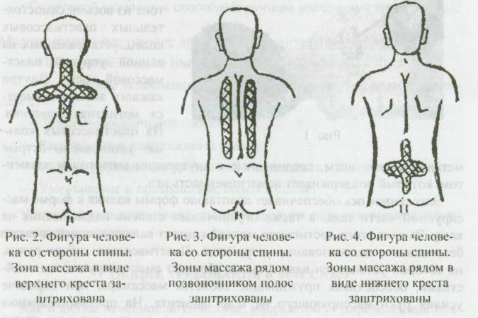 Схема массажа при сколиозе