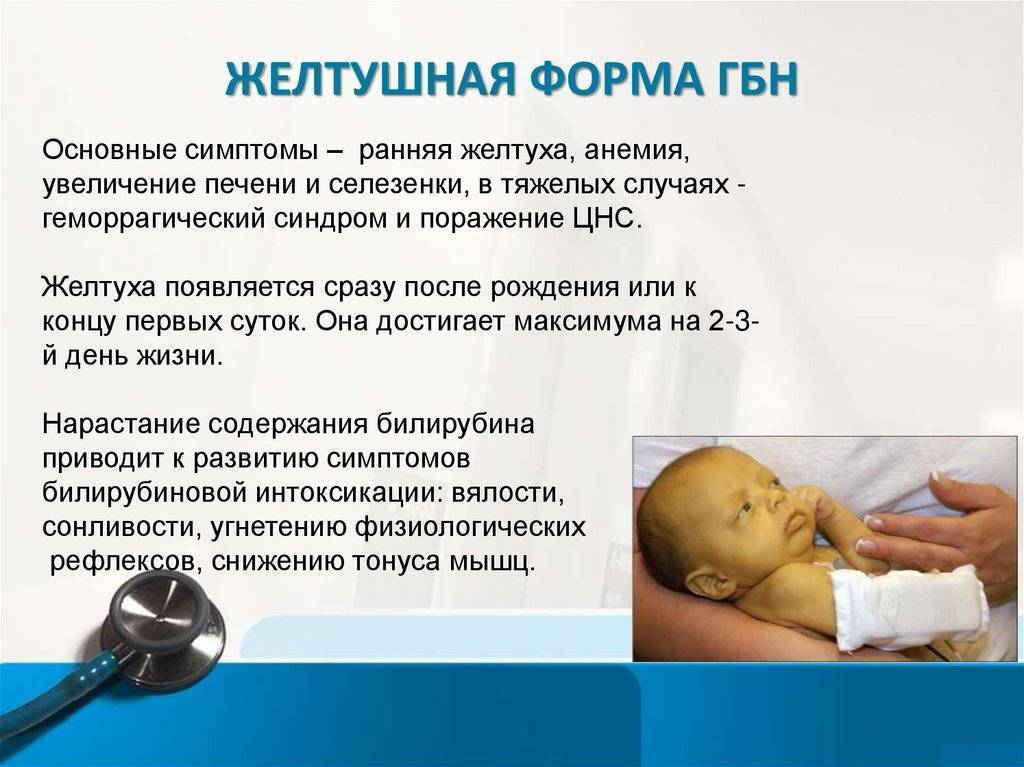 Желтуха у новорожденных – физиологическая и патологическая, симптомы и лечение — клиника isida киев, украина