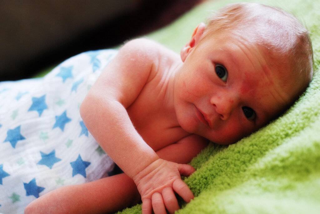 Как видят новорожденные: особенности зрения ребенка