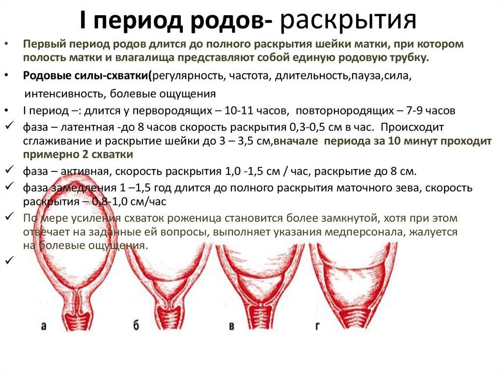 Подбор влагалищных пессариев при опущении матки и влагалища в красноярске | андро-гинекологическая клиника, ооо.