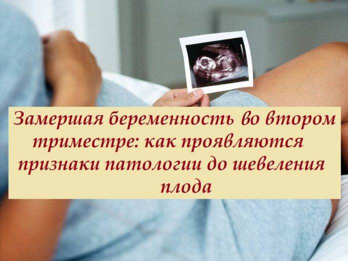 Замершая беременность: причины и лечение * клиника диана в санкт-петербурге