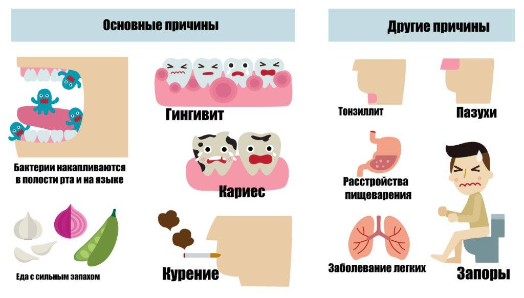 Причины белого налета на языке у ребенка