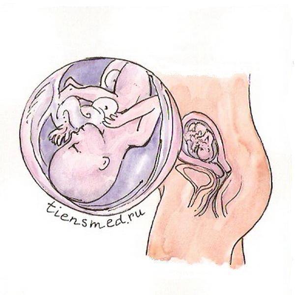 Каковы нормы развития плода по неделям беременности и почему может появиться зувр?