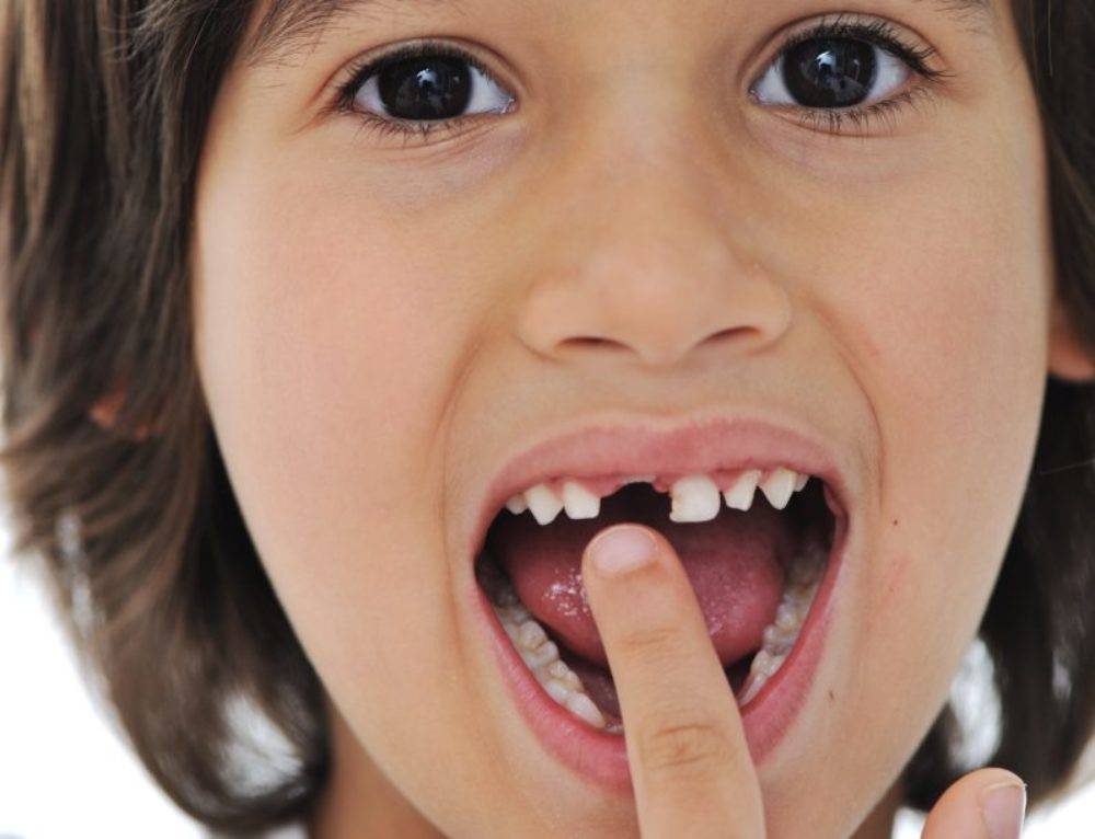 Выпадение зубов у детей — причины, порядок, возраст, типовые проблемы