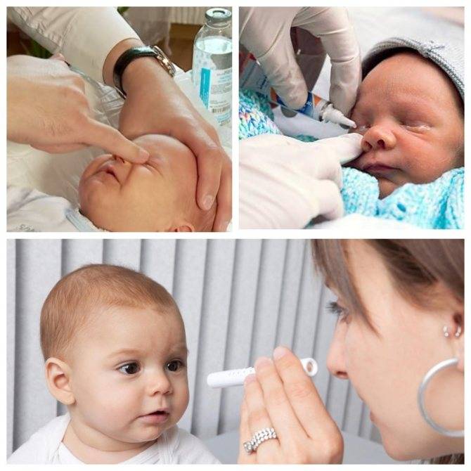 Техника массажа слезного канала у новорожденных при дакриоцистите с видео-инструкцией от доктора комаровского