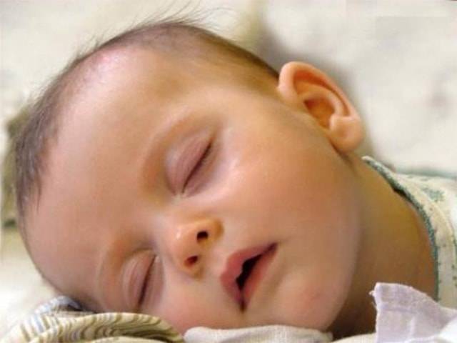 Почему у грудного ребенка сильно потеет голова во время сна?