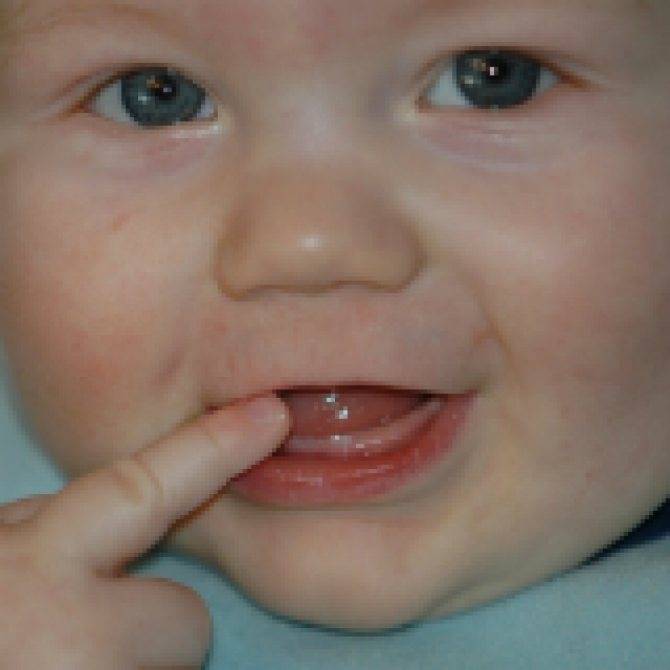 Рвота при прорезывании зубов у детей