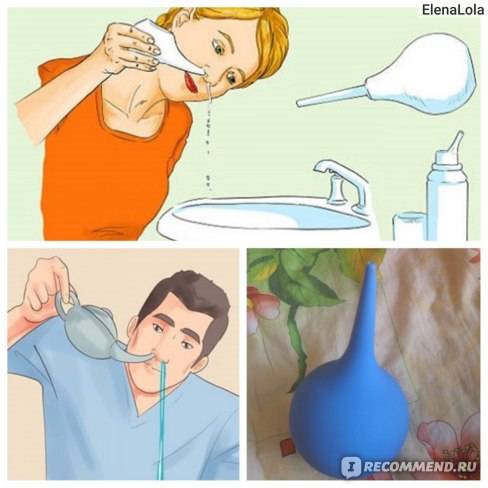 Как промыть нос при гайморите, насморке, простуде