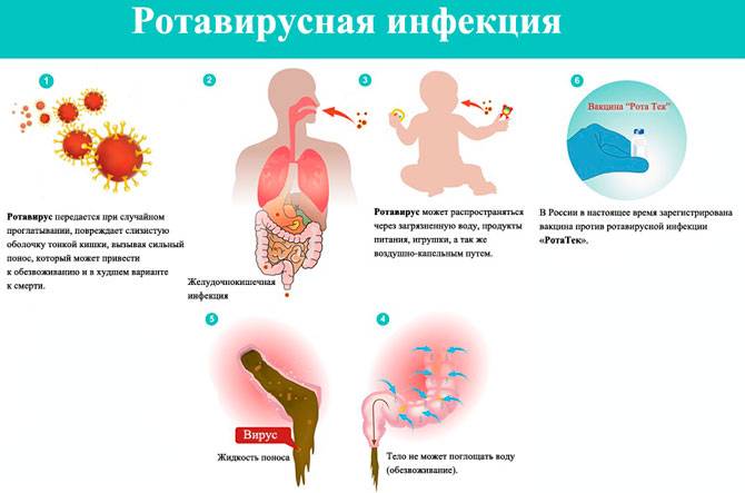 Ротавирусная инфекция (кишечный грипп)