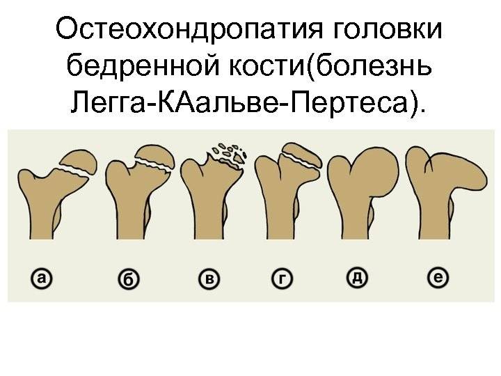 Запор у детей - причины, симптомы, диагностика и лечение в челябинске и екатеринбурге