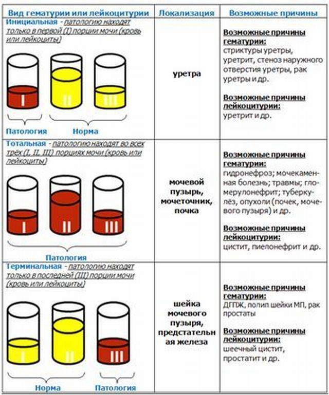 Бактериологический анализ мочи: посев мочи на микрофлору