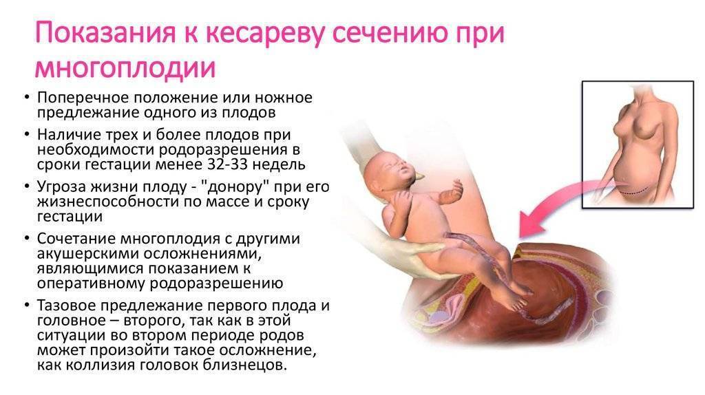 Аборт (выкидыш) - прерывание беременности | университетская клиника