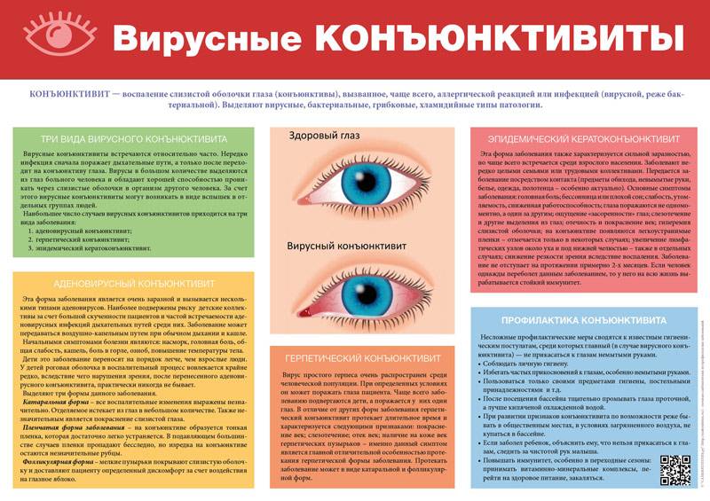 Что такое конъюнктивит: симптомы, причины, виды, лечение и профилактика - энциклопедия ochkov.net