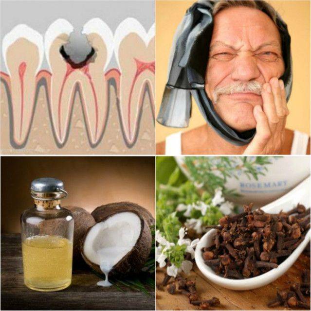 15 отличных способов за секунды справиться с зубной болью