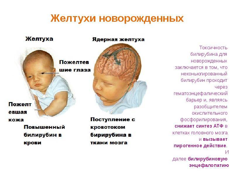 Гипоксия у новорожденных и детей старшего возраста | доктор квант
