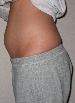 Беременность 8 недель