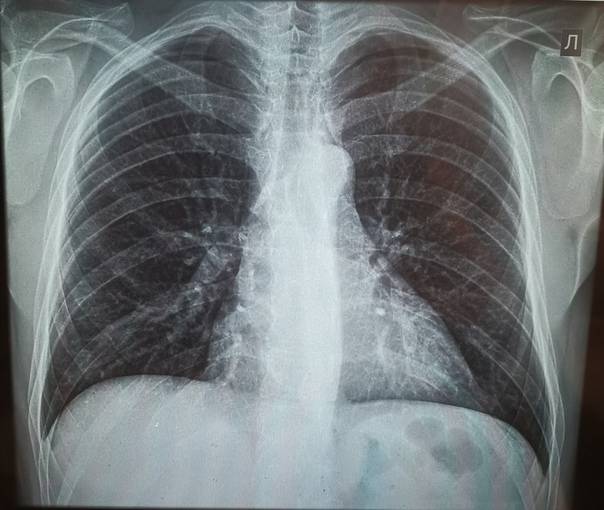 Рентген легких в москве в клинике семейный доктор, цены