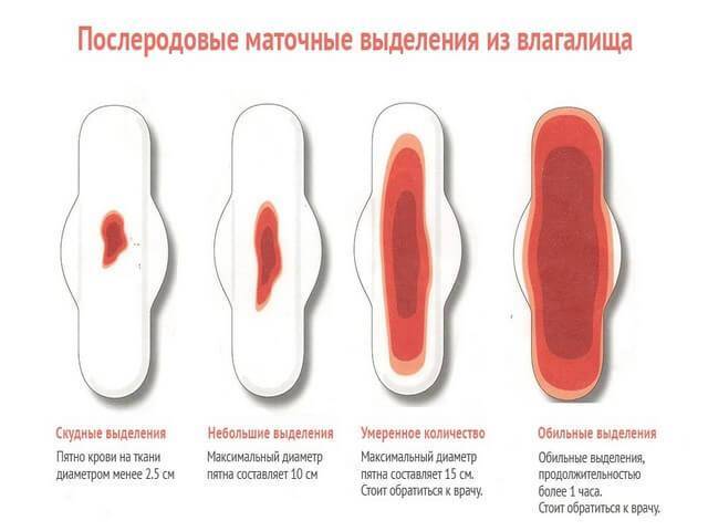 Очень скудные месячные - причина и что делать