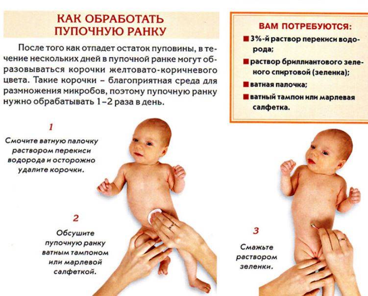 Почему кровит пупок у новорожденного. что делать, как и чем обрабатывать правильно - medside.ru