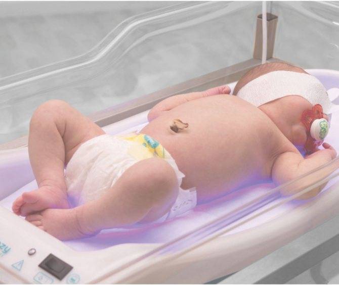 Желтухи новорожденных: причины, лечение, прогноз — онлайн-диагностика