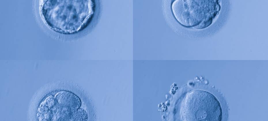 Оценка качества эмбрионов в программах эко