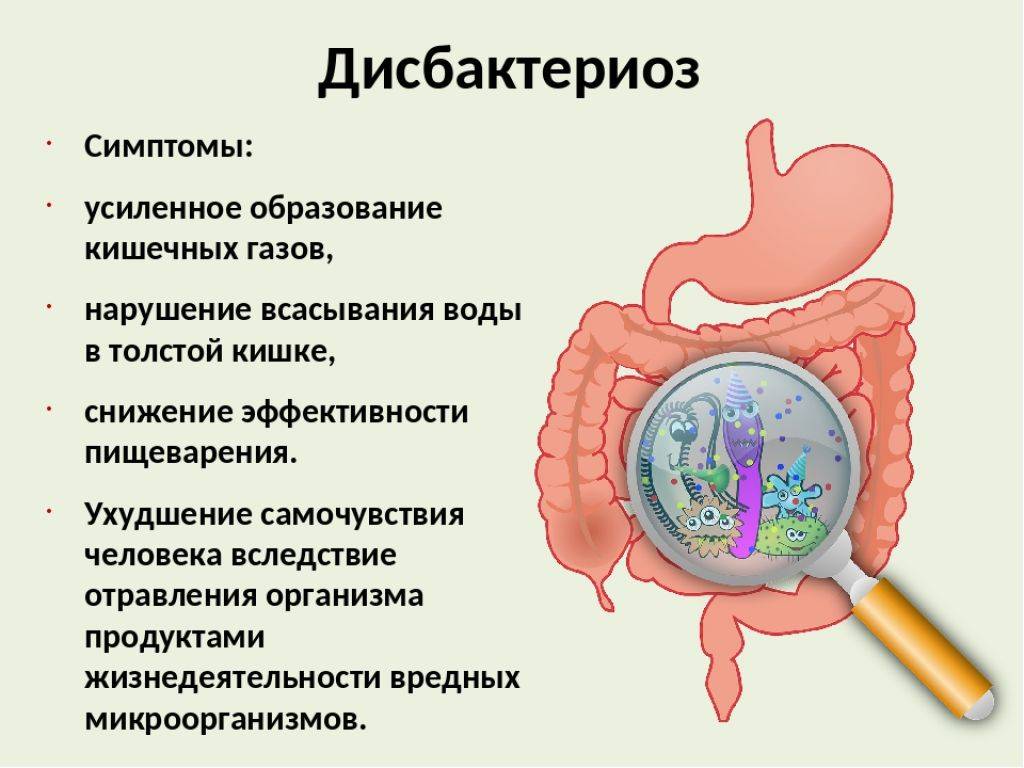 Дисбактериоз кишечника: вопросы и ответы