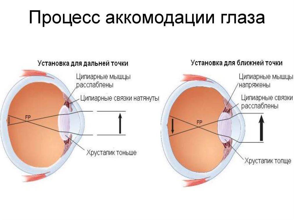 Писчий спазм (фокальная дистония кисти)