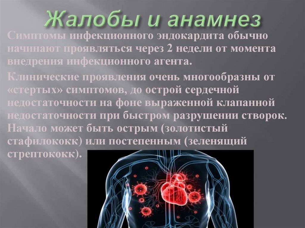 Неинфекционный эндокардит: причины, симптомы, диагностика, лечение | компетентно о здоровье на ilive