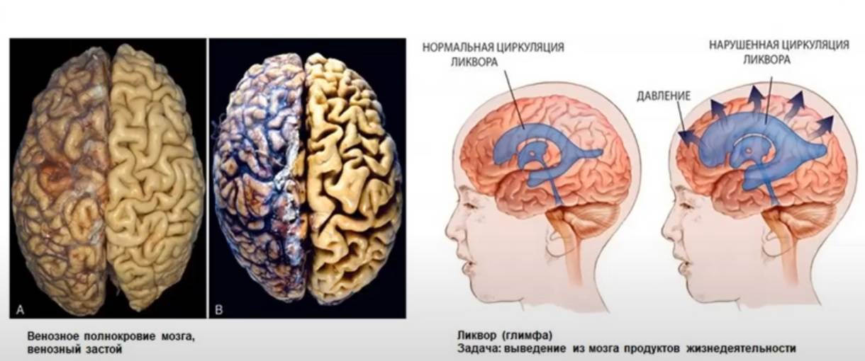 Невротические расстройства у детей и подростков