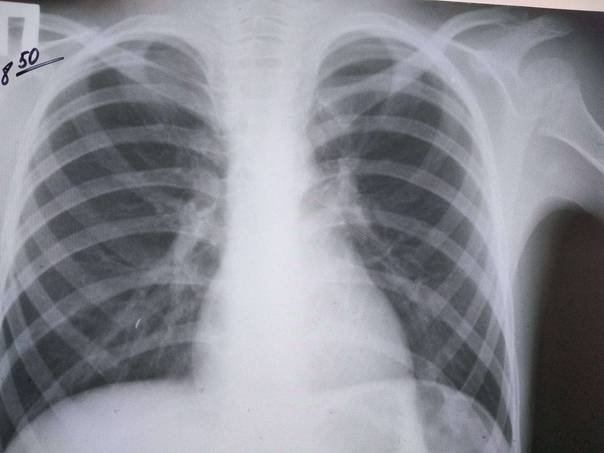 Сделать рентген. платный рентген в москве в поликлиниках ао семейный доктор